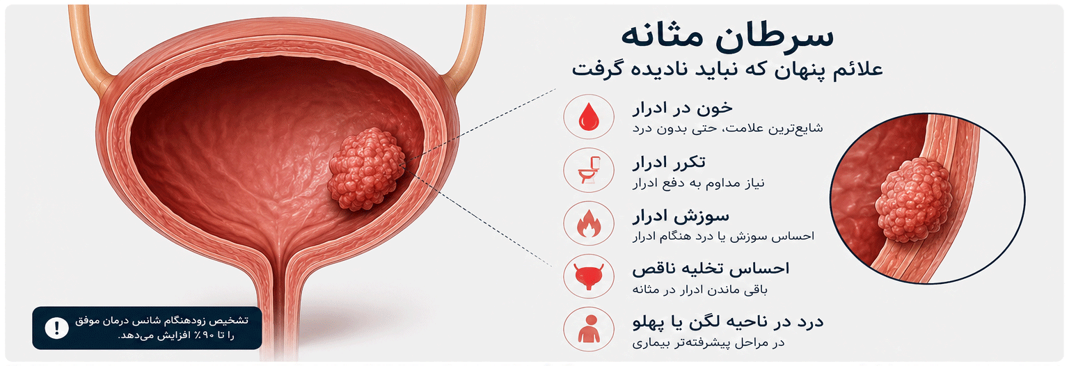 نمای شماتیک رشد تومور در دیواره مثانه و مراحل اولیه سرطان مثانه