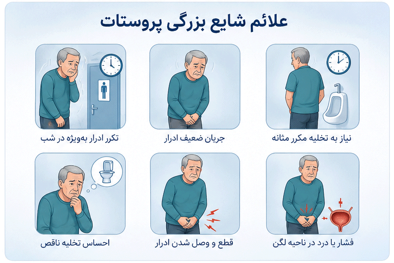 علائم بزرگی خوش‌خیم پروستات در مردان