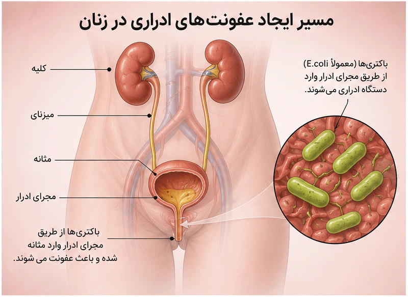 آناتومی دستگاه ادراری و مسیر ایجاد عفونت
