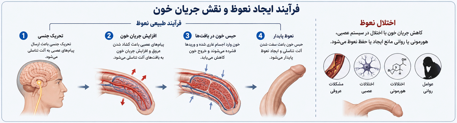 نمای شماتیک فرآیند ایجاد نعوظ در مردان و نقش جریان خون در اختلال نعوظ